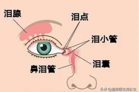 “肿泡眼”的隐匿元凶—泪腺脱垂，小心误判变糟糕！（案例分享）图片