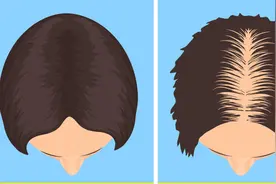 缺乏维生素D的6个警告信号图片