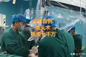 全球首例换头手术成功后 为何却又实行了安乐死图片