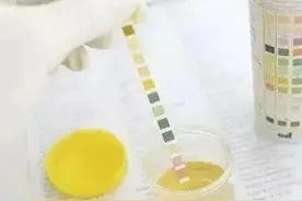 尿常规12项分析，大家都能看得懂！图片