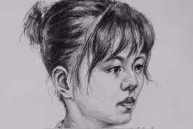 肩袖损伤诊断及关节镜下治疗图片