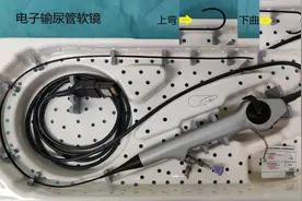 输尿管镜还分软硬？图片