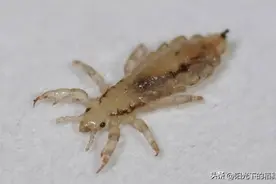 头上长了虱子，老一辈用这种方法灭虱，听的心惊肉跳，想想都怕图片