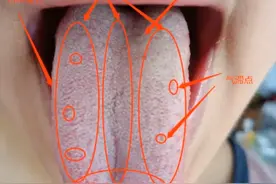 舌头有这3种表现，证明你肾亏、脾虚、有湿气、心情郁闷图片