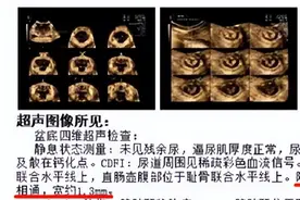 产后第一天，我的便便从阴道里出来了图片