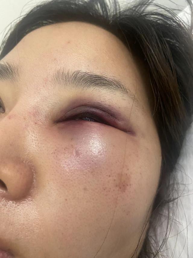 女子柬埔寨遭性侵报警要付小费