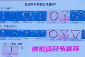 琳琅满目的节育环总有一款适合你图片
