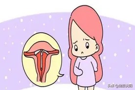 健康科普堂 | 上环需要了解的那些事儿图片