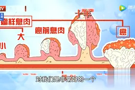 肠道有湿热，当心息肉复发！“息肉体质”有3个特征！两招改善图片