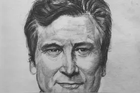 肘关节“恐怖三联征”术后再遇尺骨鹰嘴骨折，认真些！再认真些图片