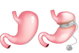 导致胃痉挛的5大诱因！原来胃也会抽筋图片