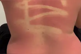 这是敷衍的痕迹！老婆在海边给老公涂抹防晒霜，老公背部让网友心疼图片