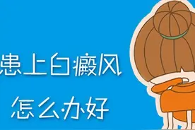对于儿童白癜风该怎么治呢?图片