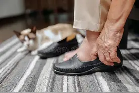 医生：我不就是腿肿吗，咋这么严重？腿肿5大原因你搞明白了吗？图片
