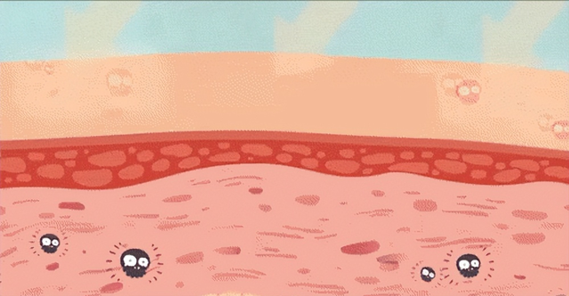 为什么老了就变黑、变黄？什么东西能去掉黑色素，让皮肤变白