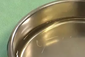 2岁男童眼睛现4条寄生虫游动：患儿曾有过犬类密切接触史图片