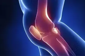 关节咔咔响是怎么回事？是不是要补钙了？图片