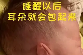 【0-3岁使用，越早效果越好】纠正0-3岁婴幼儿童耳廓...图片