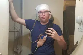 因为害怕死亡，美国小哥动手术切掉部分大脑：彻底消除恐惧感图片