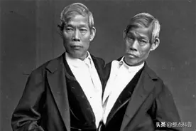 连体兄弟胸腔相连、共用肝脏，二人娶了一对亲姐妹，生下22个孩子图片