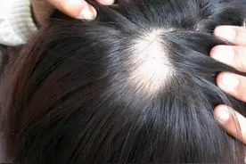 40岁浙江女子，用盐水洗头发，坚持一段时间，出现了哪些变化？图片