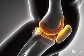 痛风患者如何平稳尿酸？坚持每天做好4件事，尿酸想高也高不了图片