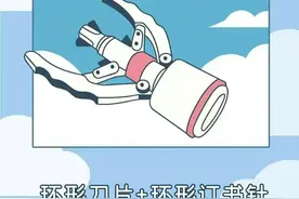 男生包皮太长对身体会有什么影响？需要“割掉”吗？对此你怎么看图片