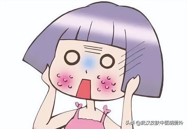 首先有可能是过敏,面部长期裸露在外,总是能接触到一些微生物,尘埃