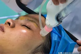 推荐几个适合普通人做的医美项目，评价好、性价比高的那种图片