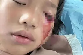 江苏13岁男孩打瞎女童眼睛后续！鉴定轻伤，不赔钱，不立案图片