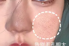 带你了解毛孔粗大的原因及护理方法图片