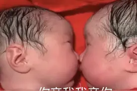 龙凤胎兄妹出生后一直"亲吻"，护士都没法分开，网友：画面很暖心图片