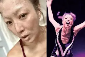 郑秀文身材暴瘦成纸片人！排骨胸、眼眶凹陷，减肥8年只吃苹果图片