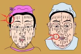 孩子身上这5个“痣”，或是“好福气”的象征，您家孩子有吗？图片