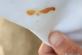 衣服锈迹别着急扔，一招轻松搞定图片