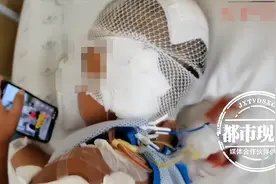 心疼！5岁男童被自家狗狗咬掉耳朵，哭得撕心裂肺图片