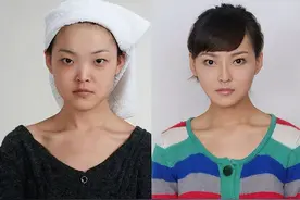 女生花上百万整容，想整成“公主”却变成“女巫”，不忍直视图片