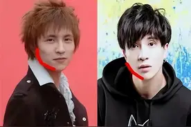 整容的4位男星：削骨、打针、垫鼻梁一点不手软，原生脸不好吗？图片