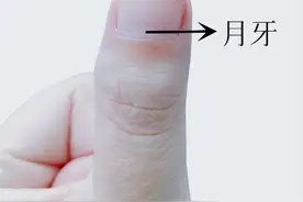 医生提醒：指甲出现这个变化，可能是癌变！别不当回事！图片