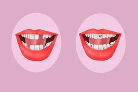 牙齿松动，恨不得用胶水粘上，这到底是怎么了？告诉你原因图片