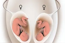 女性摘除子宫后，和正常女人有什么不同？看完有一丝心疼图片