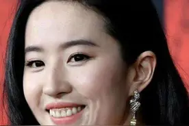 鼻孔外露不要紧，“牙龈外露”才拉垮，一笑就土气，高圆圆都遭殃图片