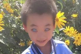 小男孩天生长有猫眼，可夜视图片