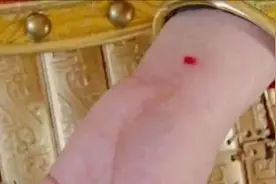 女子身上的宫鼠沙在古代真的有那么神奇吗？图片