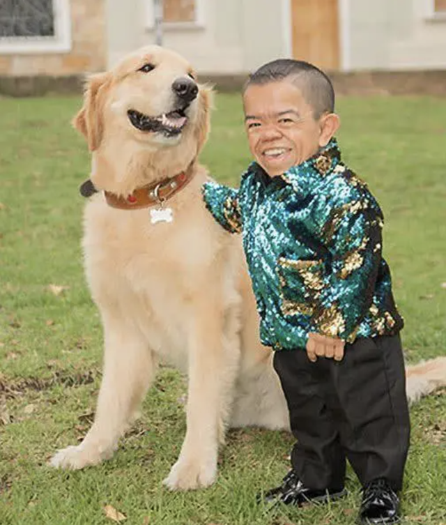 世界上最矮的十个人,人称"袖珍女",却能剖腹产连生三胎