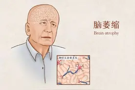 大脑开始“萎缩”，身体一般会出现3个反应，不妨仔细观察图片