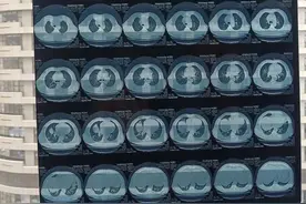 带你了解胰腺炎（原创）图片