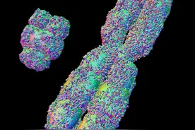 男人的染色体是XY，女人是XX，染色体是“YY”会是什么样子呢？图片