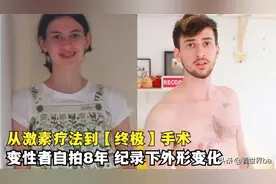 从激素疗法到“终极”手术，变性女孩自拍8年，纪录蜕变全过程图片