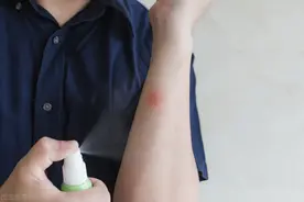 夏季户外活动一定要防毒虫，万一被毒虫咬了，要正确处理图片